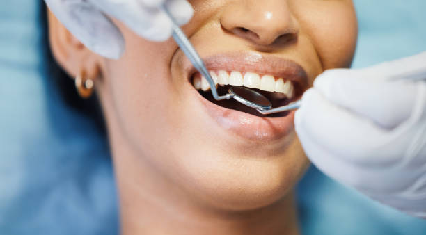 Best Emergency Dental Care for Broken or Chipped Teeth in Navasota, TX