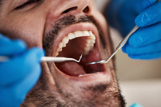 Best Weekend Emergency Dentist in Navasota, TX